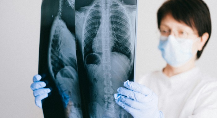 Az egészségügyi alkalmazások kiberbiztonsági kockázataira hívja fel a figyelmet az ESET